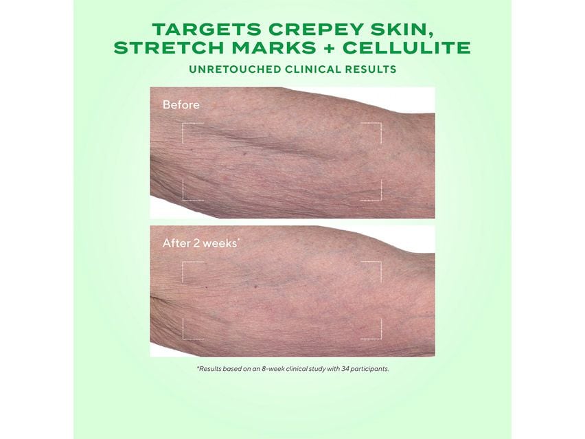 Murad Retinal Resculpt Body Treatment