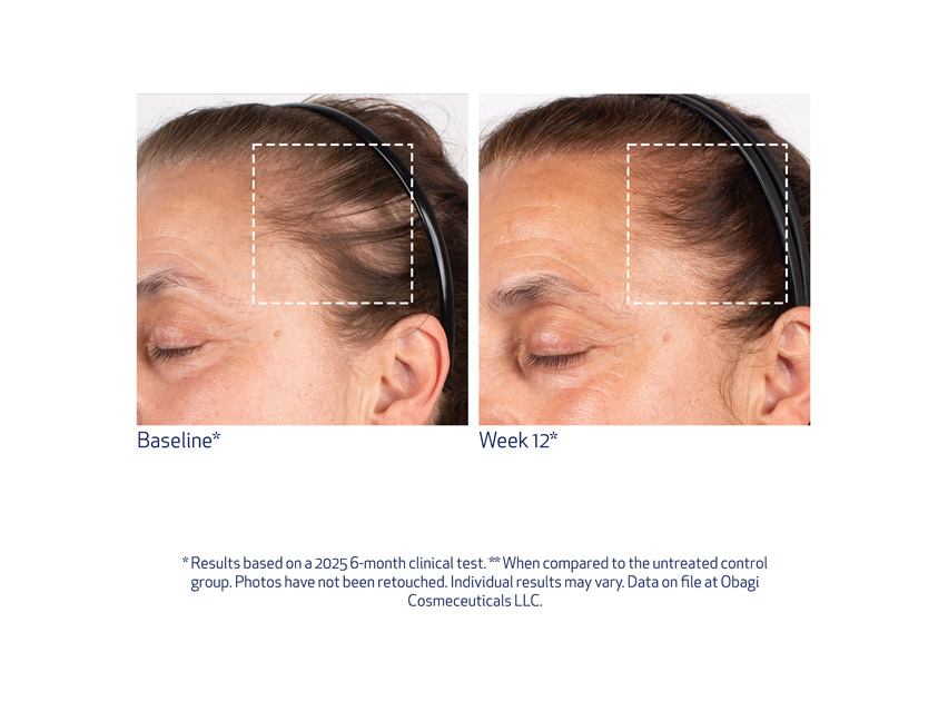 Obagi Nu-Cil BioStim Scalp Serum