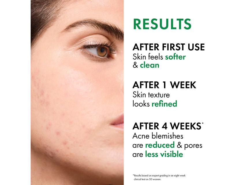 Vichy Normaderm Acne Control Daily Moisturizer