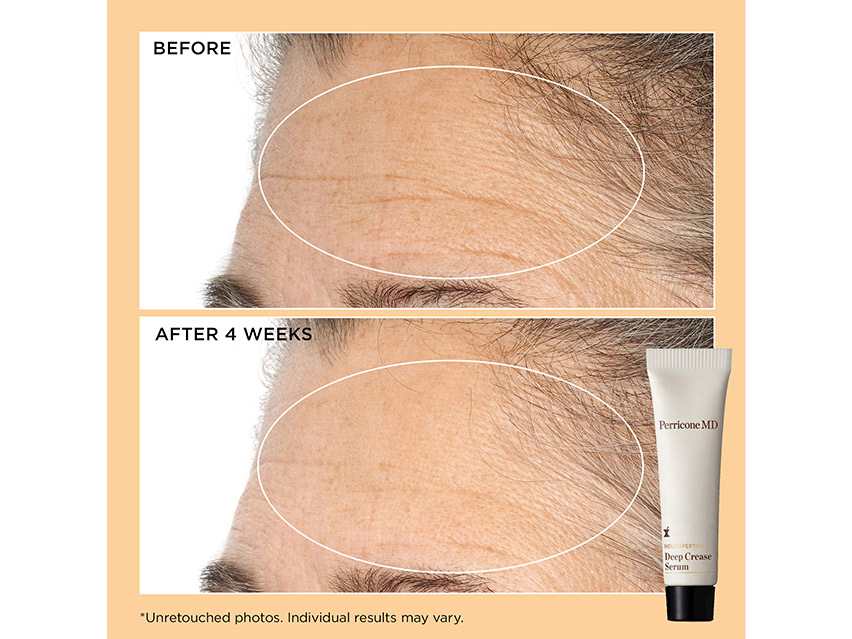 Perricone MD Neuropeptide Firm &amp; Lift Set