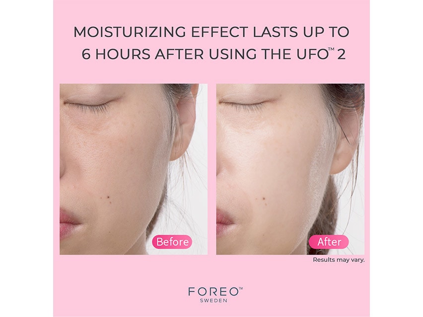 FOREO UFO | Treatment Device Facial | LovelySkin 2
