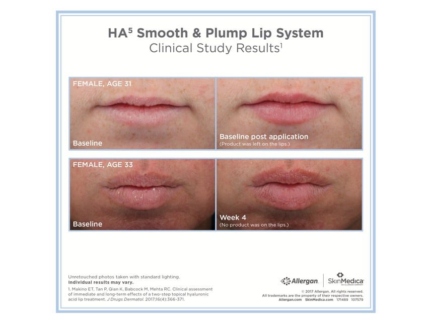 SkinMedica HA5 Smooth & Plump Lip System