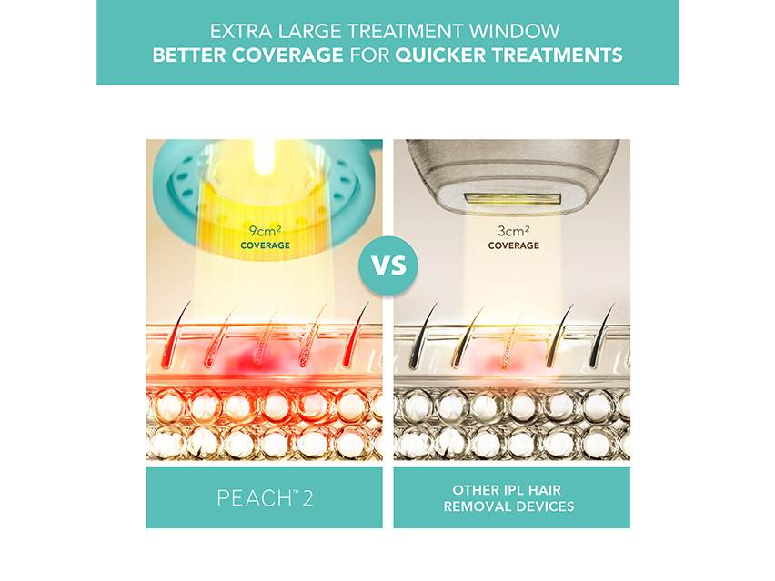 FOREO Peach 2 IPL Hair Removal Device &amp; PEACH Cooling Prep Gel Set - Limited Edition