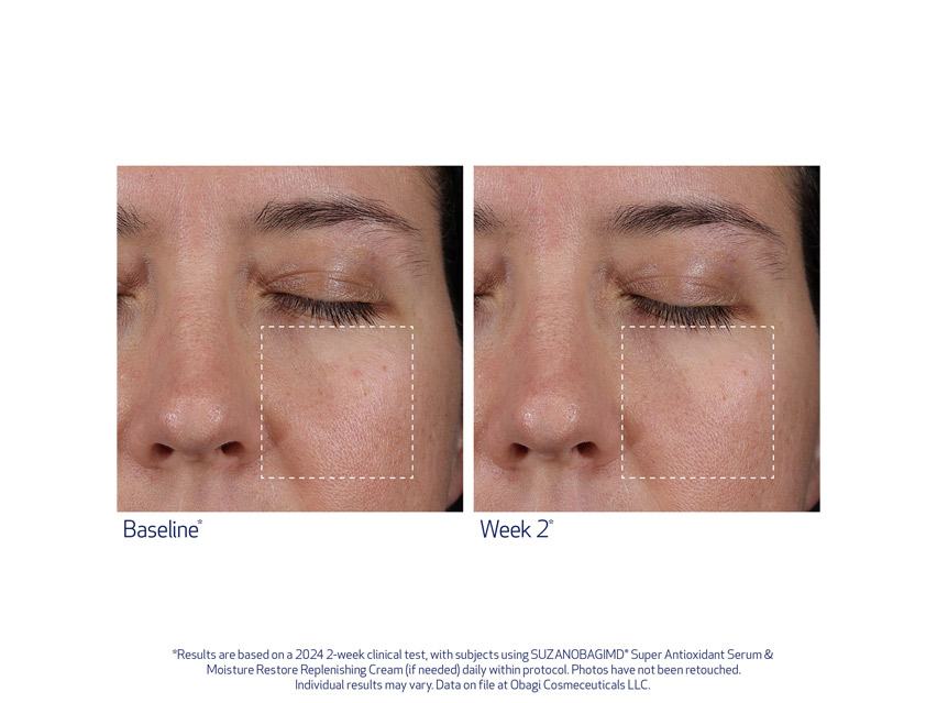 SUZANOBAGIMD Super Antioxidant Serum