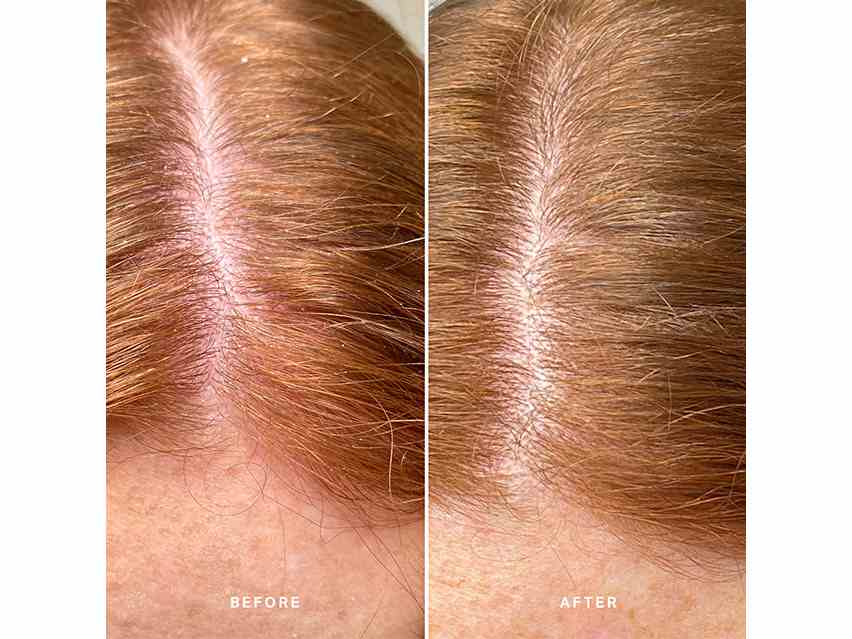 Alpha-H Healthy Scalp Exfoliating Treatment