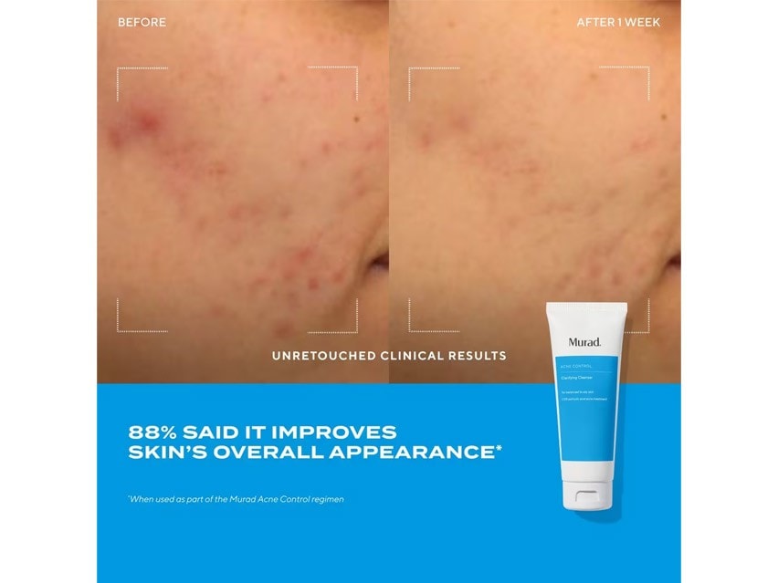 Murad Acne Control Clarifying Cleanser