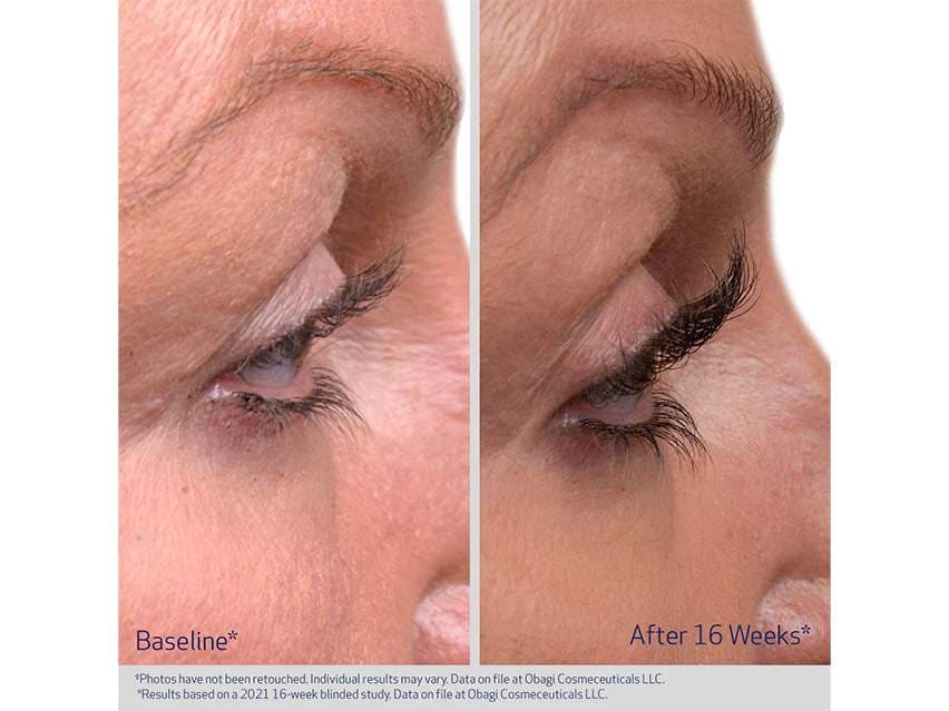 Obagi Nu-Cil™ Eyelash Enhancing Serum