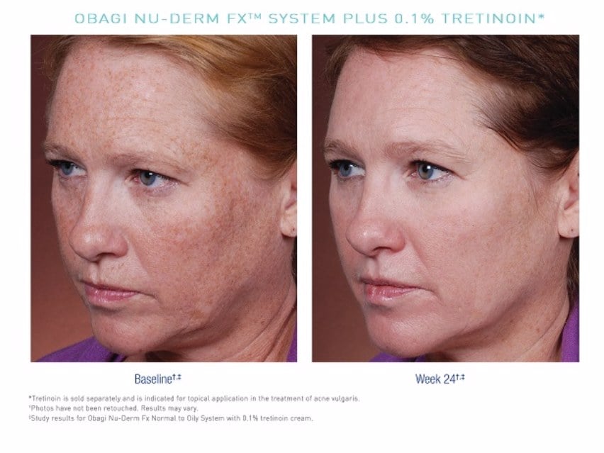 Obagi-C Fx System - Normal to Oily Skin