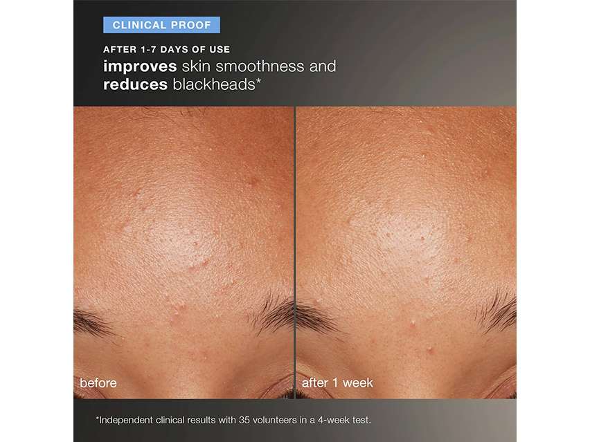 Dermalogica Daily Microfoliant