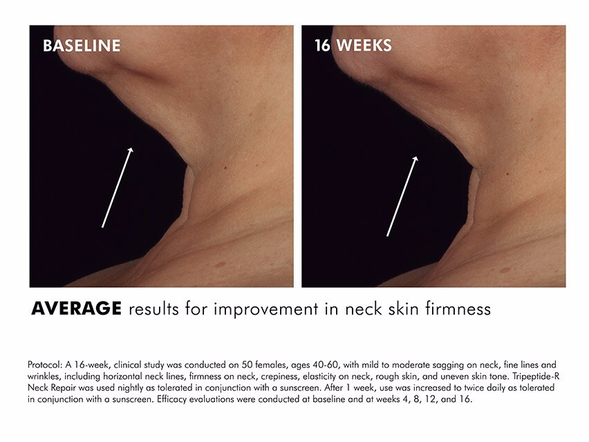 neck repair skinceuticals