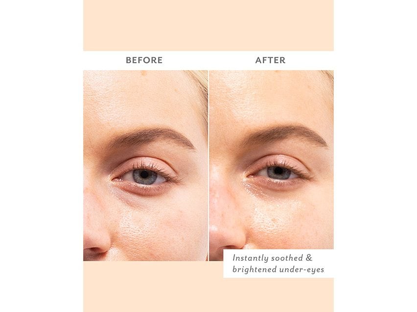 patchology Skin Remedy Soothing Eye Gels