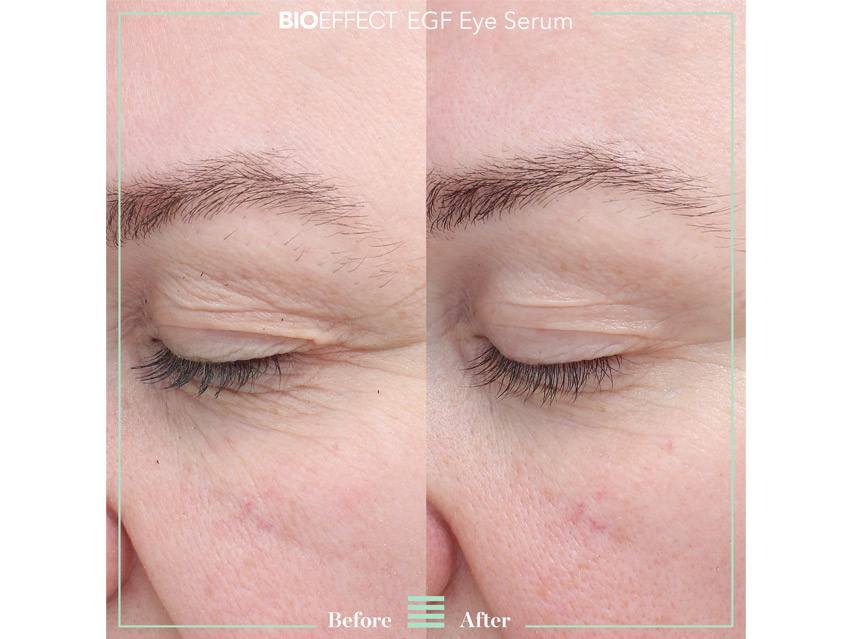 BIOEFFECT EGF Power Eye Cream