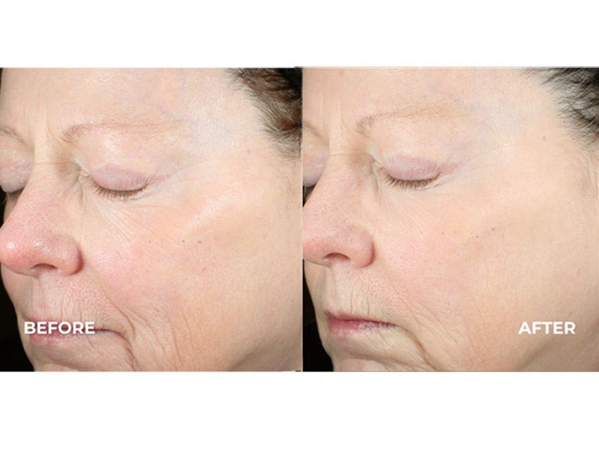 derma e Skin Restore Advanced Peptides &amp; Collagen Eye Cream