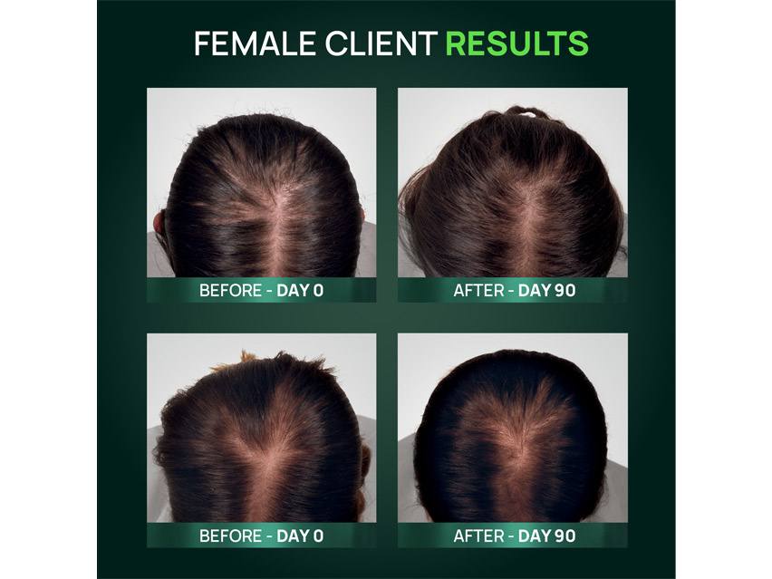 Rene Furterer Triphasic Reactional Hair Thickening Serum