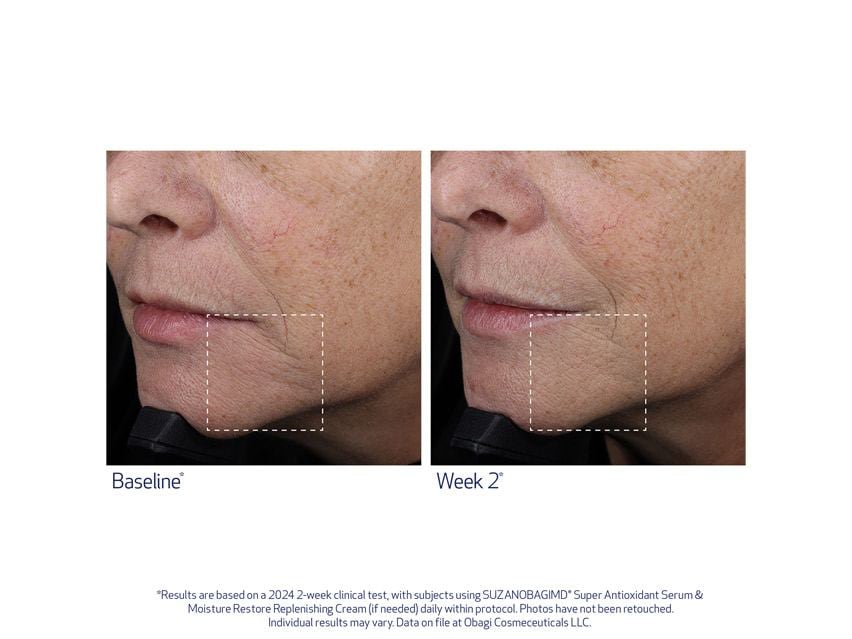 SUZANOBAGIMD Super Antioxidant Serum