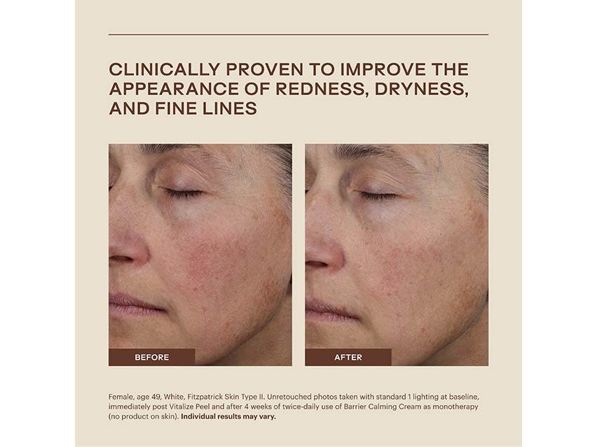 SkinMedica Barrier Calming Cream