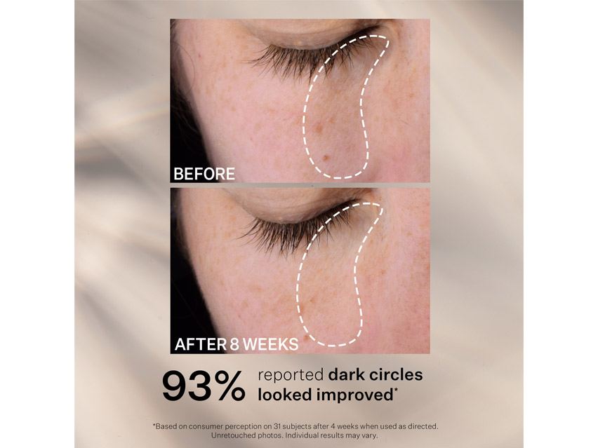 StriVectin Multi-Action Super-C Dark Circle Brightening Eye