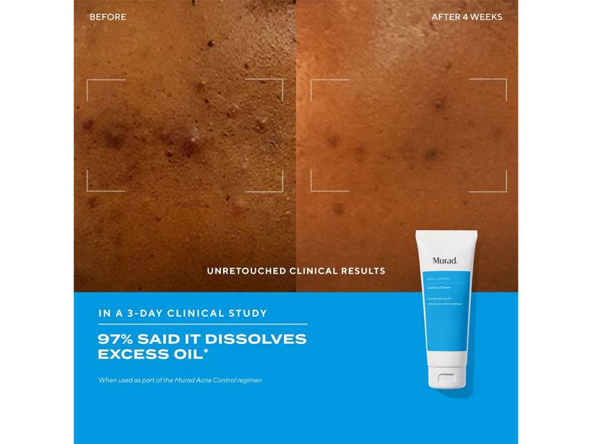 Murad Acne Control Clarifying Cleanser