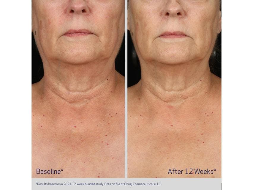 Obagi ELASTIderm Neck &amp; Decollete Concentrate