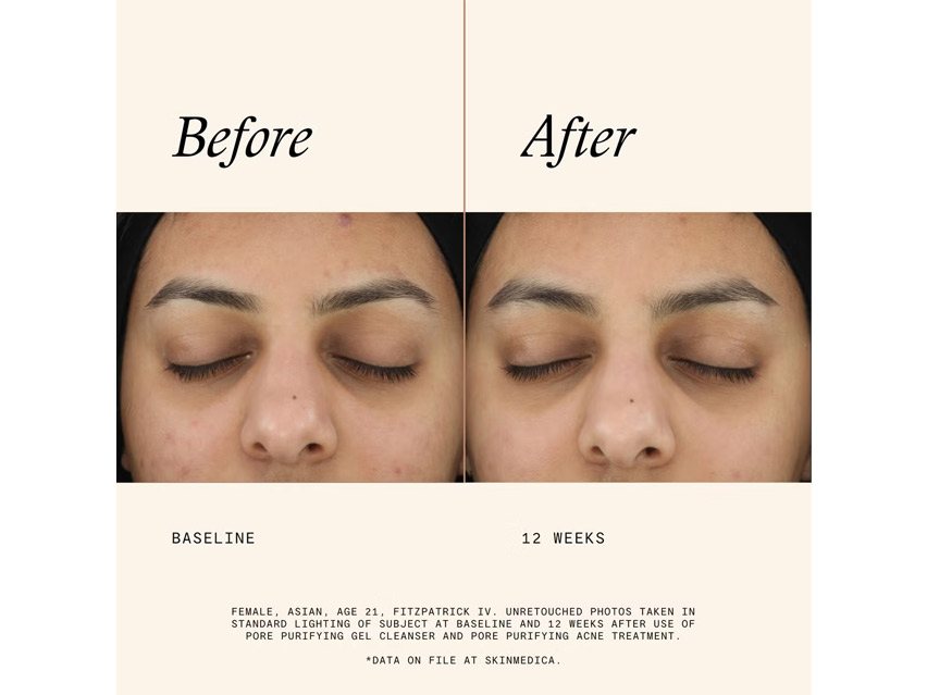 SkinMedica Pore Purifying Gel Cleanser