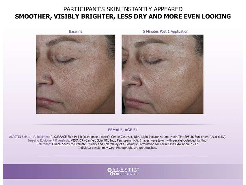 ALASTIN Skincare ReSURFACE Skin Polish