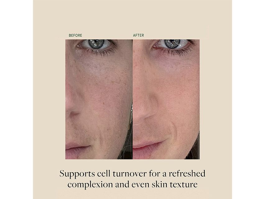 Kat Burki Retin-C Treatment Complex