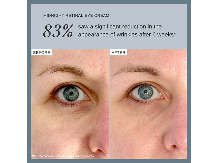 Alpha-H Midnight Reboot Retinal Eye Cream