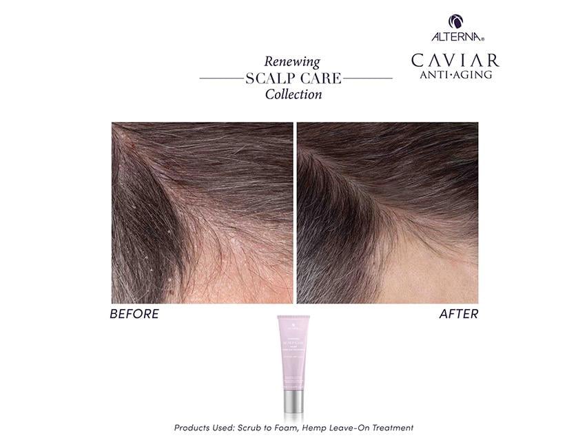 Alterna Renewing Scalp Care Hemp Leave-On Treatment