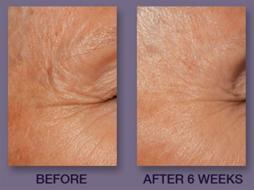 defenage 3d eye radiance cream