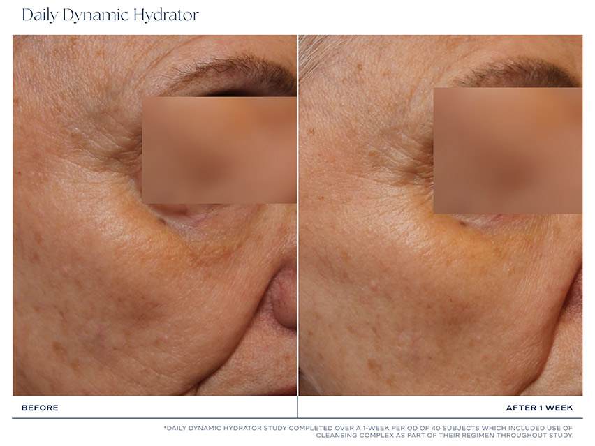 iS CLINICAL Daily Dynamic Hydrator