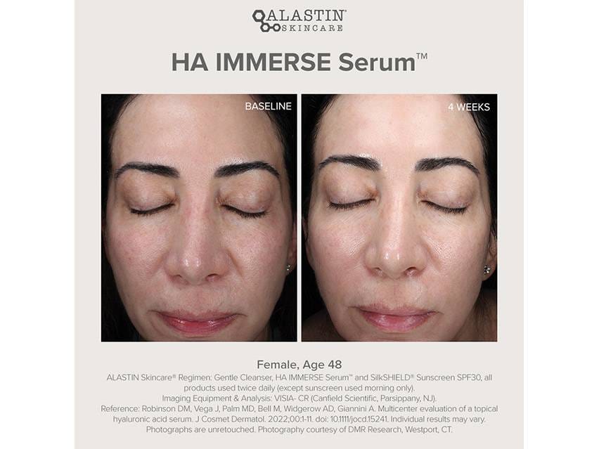 ALASTIN Skincare INhance Post-Injection Serum with TriHex Technology