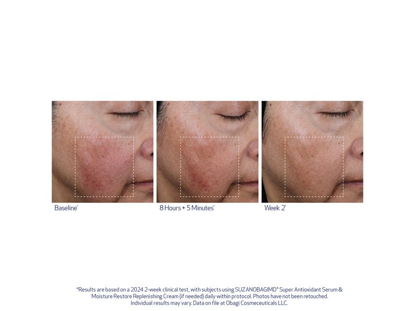 SUZANOBAGIMD Super Antioxidant Serum