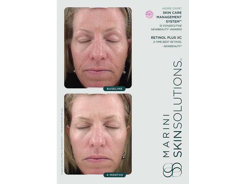 Marini SkinSolutions Retinol Plus XC Face Cream