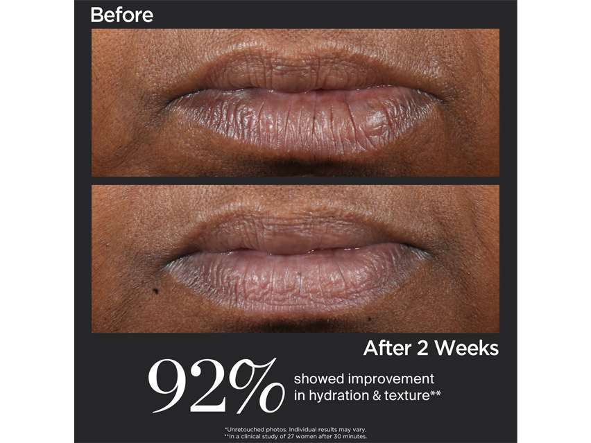Perricone MD Cold Plasma Plus+ Lip Therapy