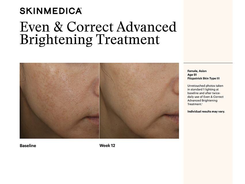 SkinMedica Even &amp; Correct Dark Spot Cream
