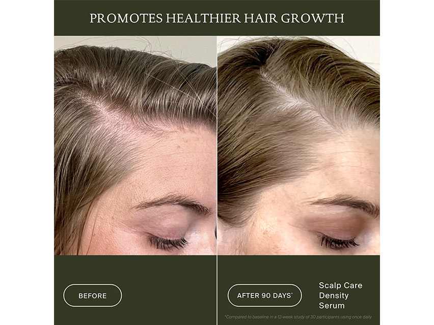 Living Proof Scalp Care Density Serum
