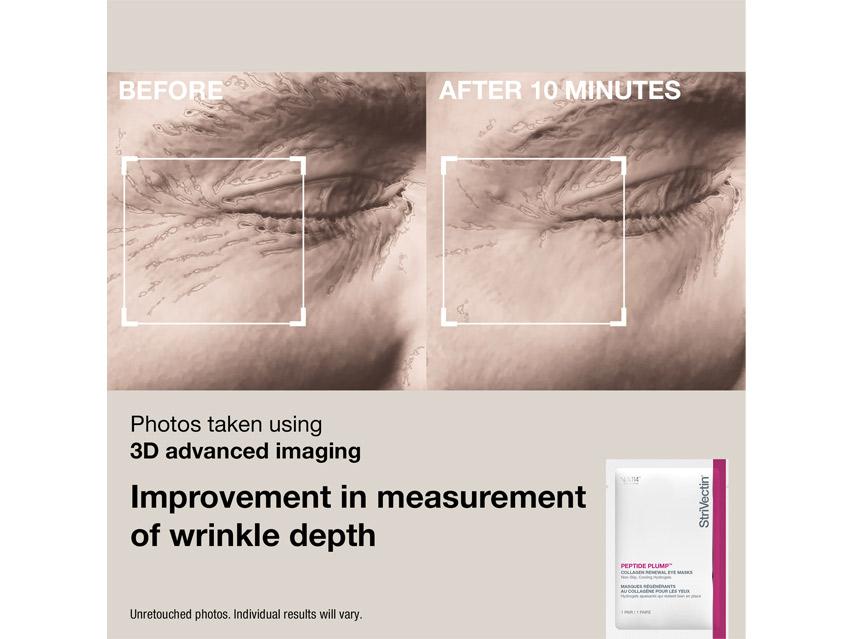 StriVectin Discovery Kit - Limited Edition