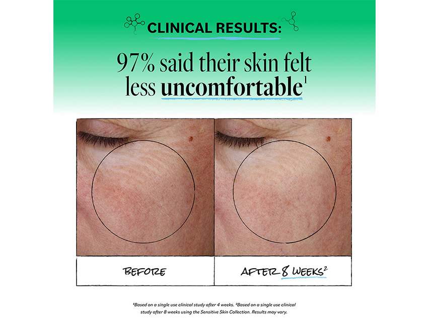 derma e Sensitive Skin Moisturizer