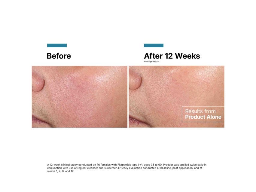 SkinCeuticals Advanced RGN-6 Aesthetic Recovery Cream