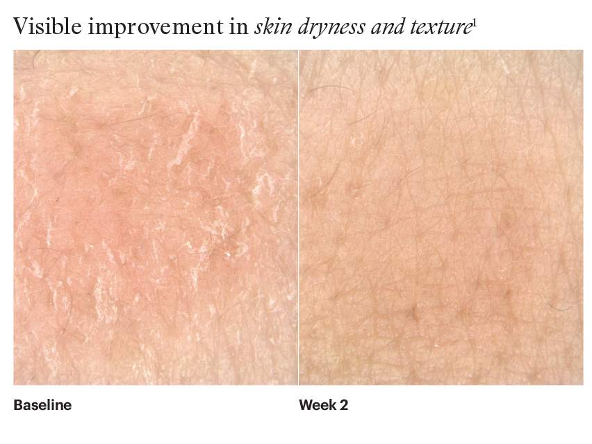 SkinMedica HA5 Hydra Collagen Hydration Regimen