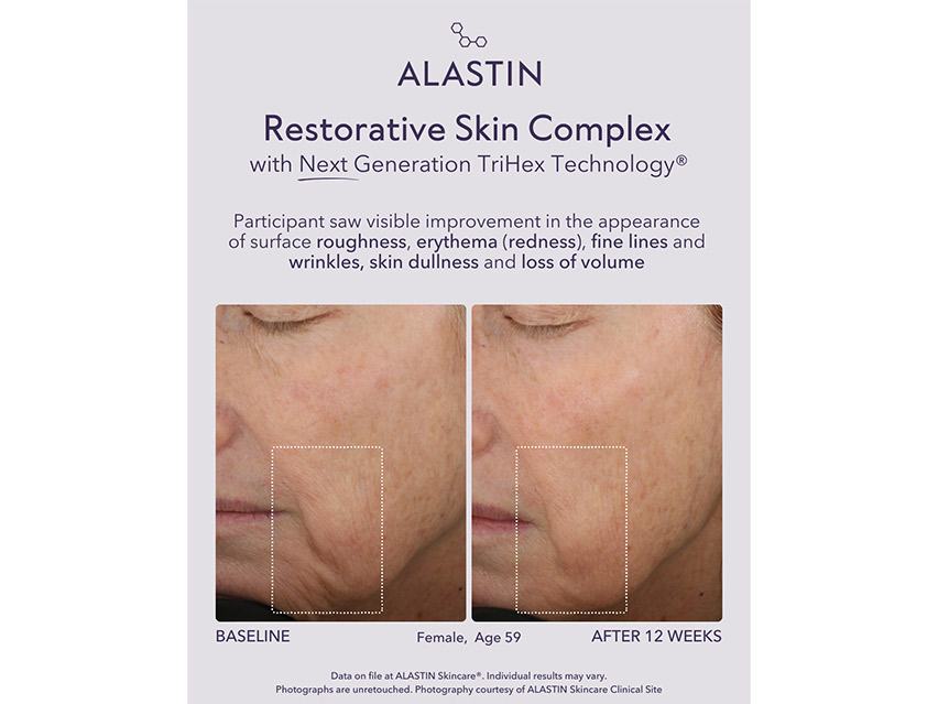 ALASTIN Skincare Restorative Skin Complex with TriHex+