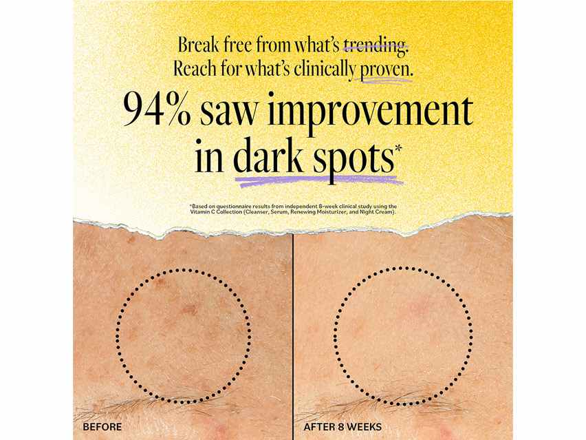 derma e Vitamin C Renewing Moisturizer