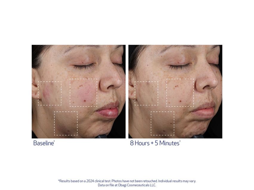 SUZANOBAGIMD Moisture Restore Hydration Replenishing Cream