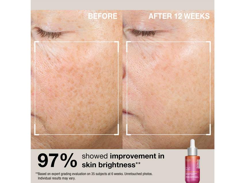 StriVectin Multi-Action Glow &amp; Protect Set - Limited Edition