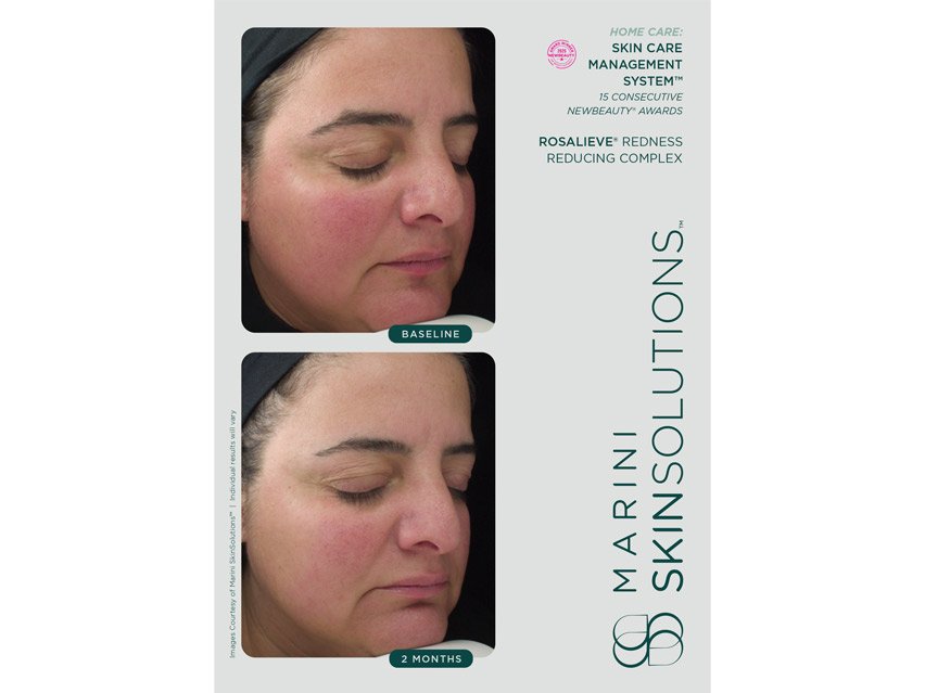 Marini SkinSolutions RosaLieve® Redness Reducing Complex Face Lotion