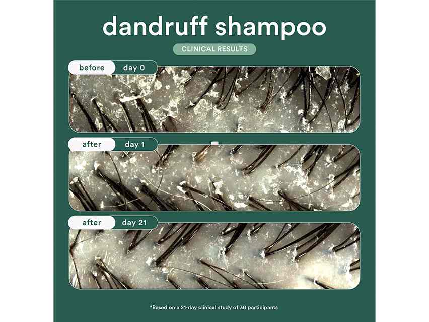 Verb Dandruff Shampoo