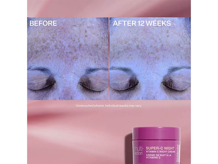 StriVectin Multi-Action Trio Brighten &amp; Restore