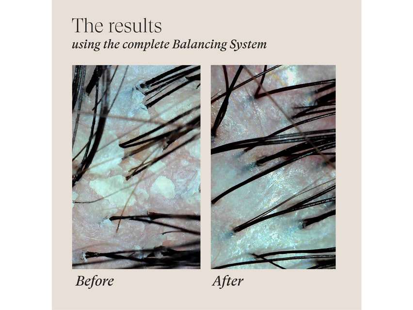 L'ANZA Scalp Therapy Balancing System - Limited Edition