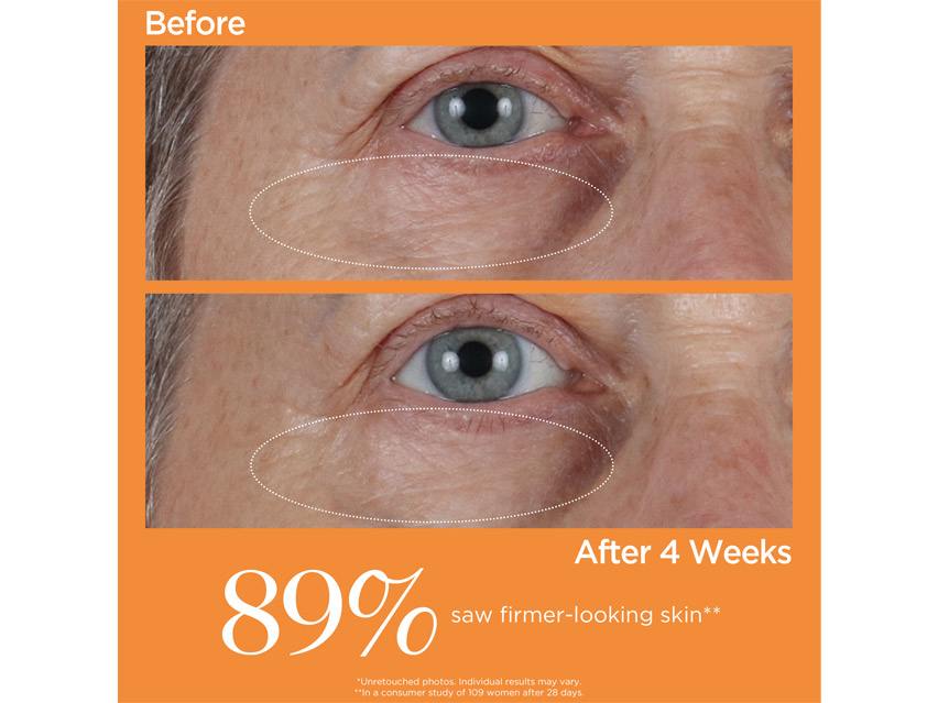 Perricone MD Vitamin C Ester CCC+ Ferulic Brightening Under Eye Cream