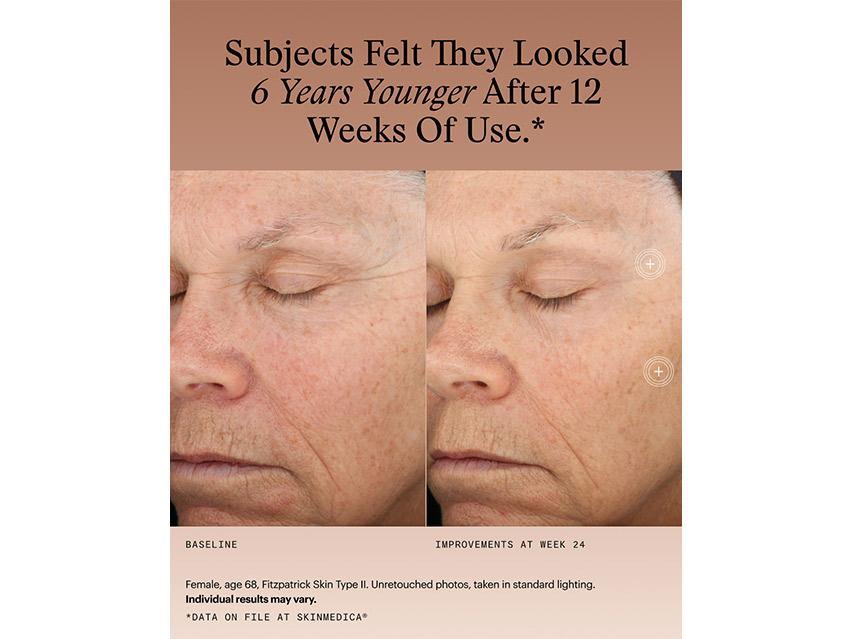 SkinMedica Rapid Weight Loss Set with TNS Advanced+ Serum